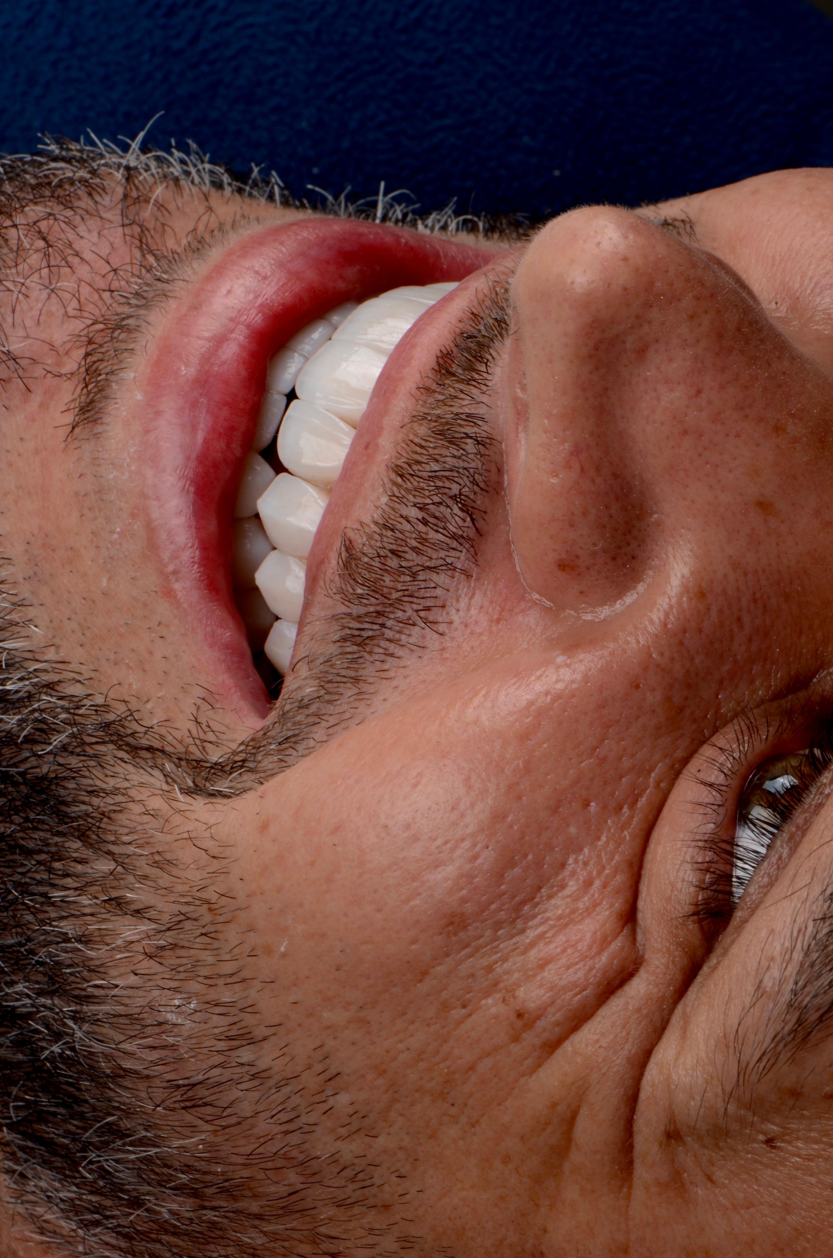 Tratamento odontológico